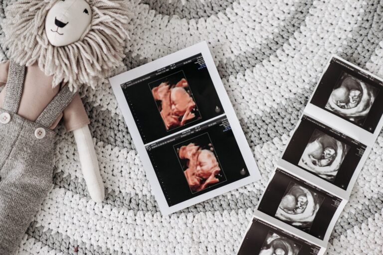 Diagnosi prenatale: scopri i nostri pacchetti ecografici